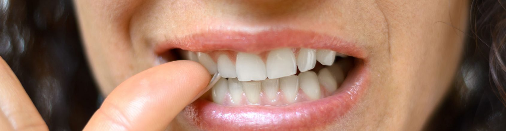 Dental habits you should break