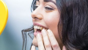 Botox in dentistry at Houston