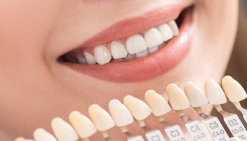 What Is a One-Visit Crown?